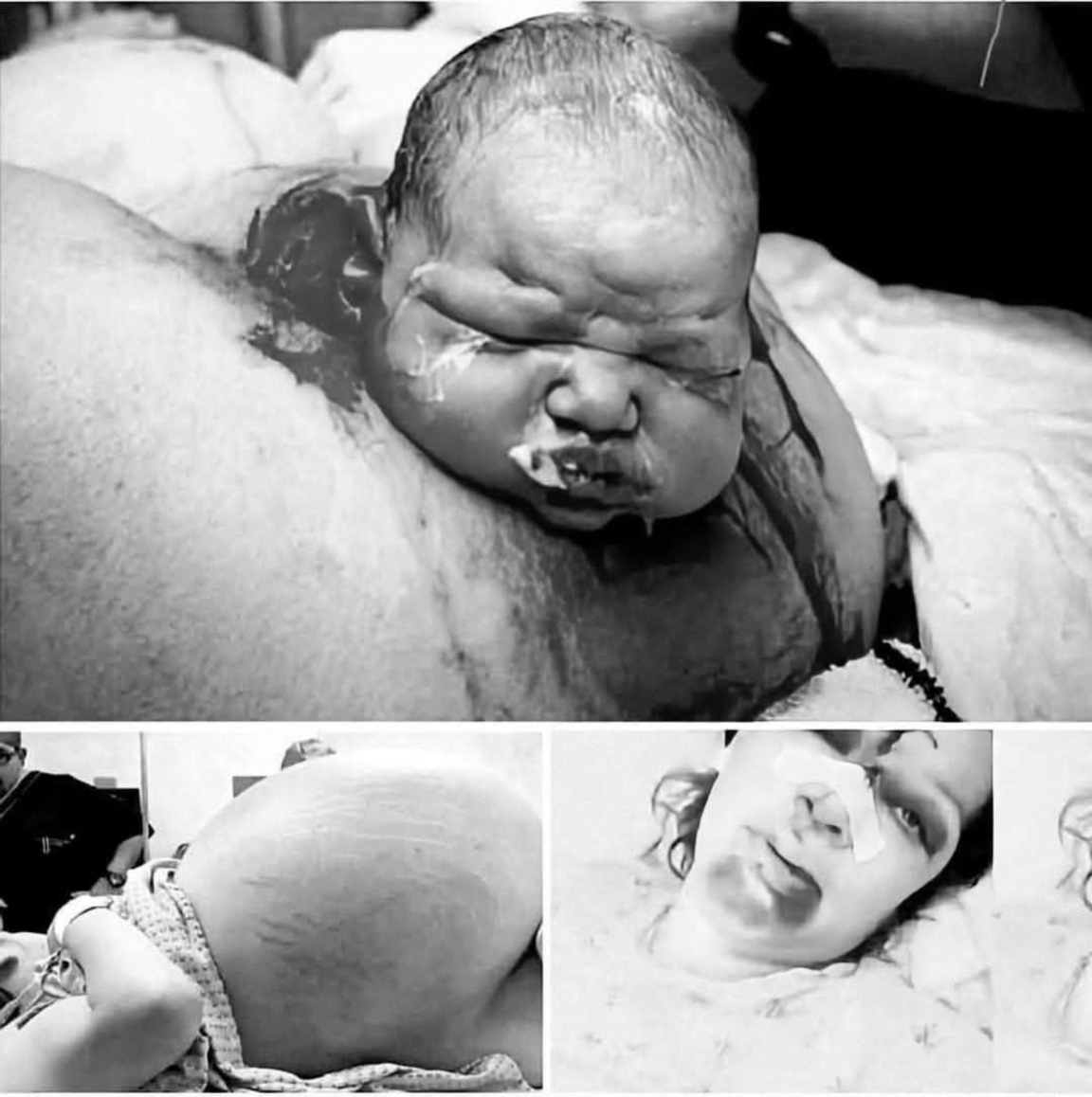 😭😭Mother gives birth in the middle of…see more