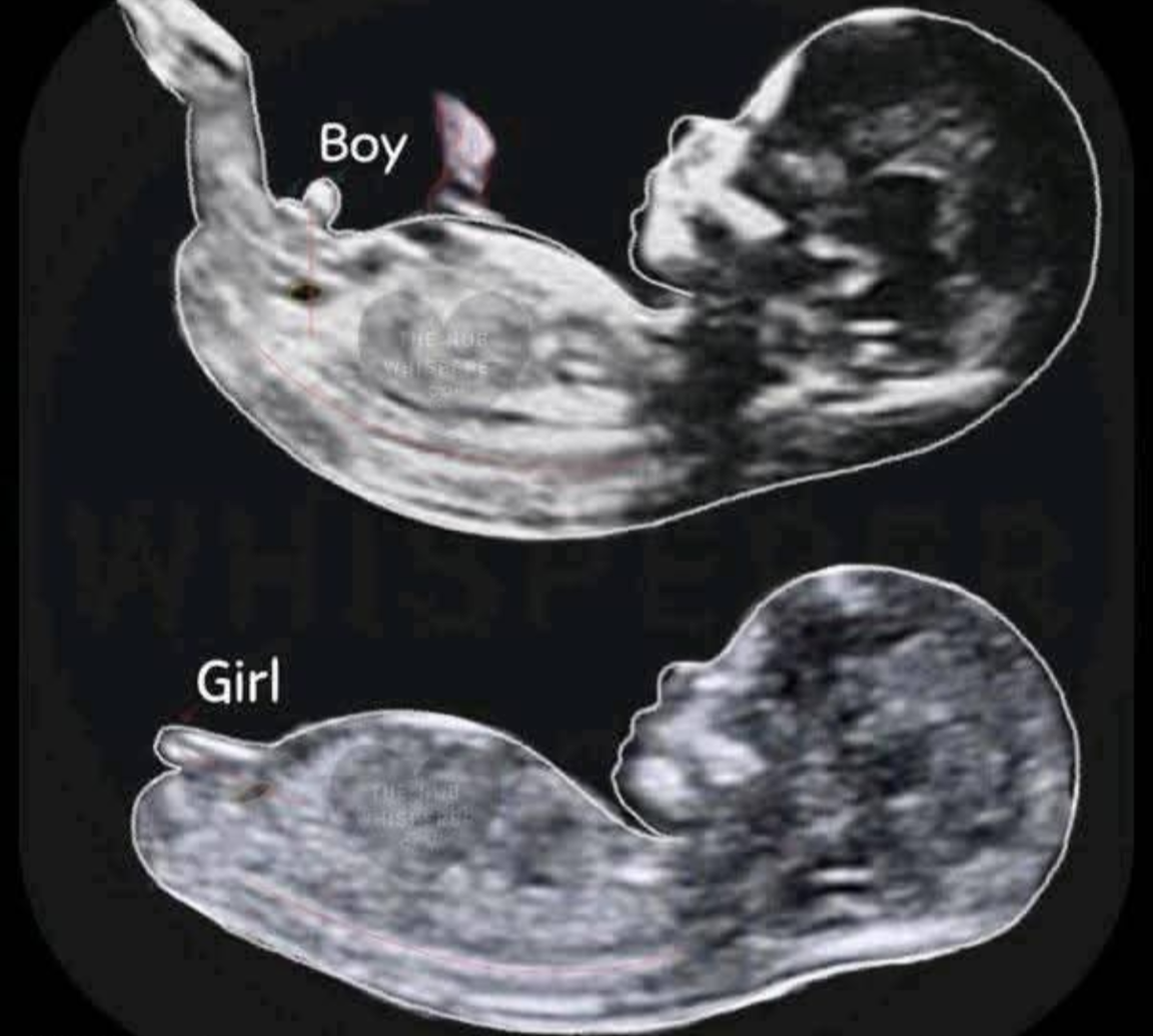 😱Common Myths About Pregnancy